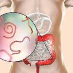 animación cuerpo con parásitos