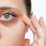 mujer con ojeras moradas